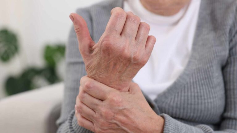 Applying for Disability Benefits with Rheumatoid Arthritis SSA Requirements